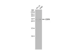 Anti-CD74 antibody [N1N2], N-term used in Western Blot (WB). GTX110477
