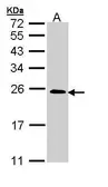 Anti-TC21 antibody [N1C3] used in Western Blot (WB). GTX110559