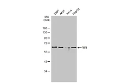 Anti-YY1 antibody used in Western Blot (WB). GTX110625