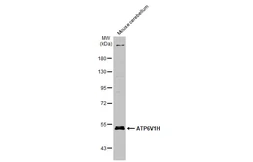Anti-ATP6V1H antibody [N3C3] used in Western Blot (WB). GTX110778