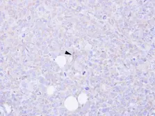 Anti-CARD9 antibody [N1N3] used in IHC (Paraffin sections) (IHC-P). GTX110789