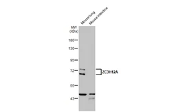 Anti-ZC3H12A antibody [N3C3] used in Western Blot (WB). GTX110807