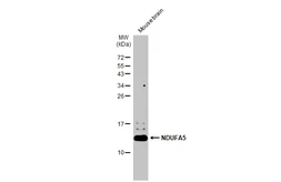 Anti-NDUFA5 antibody [N1C3] used in Western Blot (WB). GTX111016