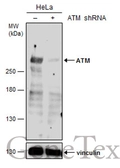 Anti-ATM antibody used in Western Blot (WB). GTX111106