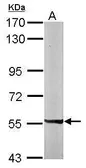 Anti-PXK antibody [N2C2], Internal used in Western Blot (WB). GTX111746
