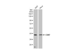 Anti-CDK7 antibody used in Western Blot (WB). GTX111919