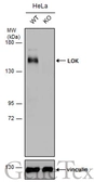 Anti-LOK antibody [N1N2], N-term used in Western Blot (WB). GTX111951