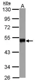 Anti-SNIP1 antibody [N1C3] used in Western Blot (WB). GTX111969