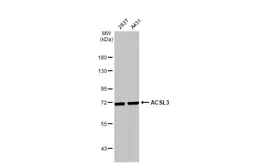 Anti-ACSL3 antibody used in Western Blot (WB). GTX112431