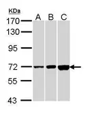 Anti-CNGA2 antibody [C1C3] used in Western Blot (WB). GTX112498