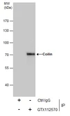 Anti-Coilin antibody used in Immunoprecipitation (IP). GTX112570