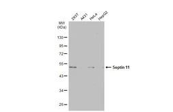 Anti-Septin 11 antibody used in Western Blot (WB). GTX112576