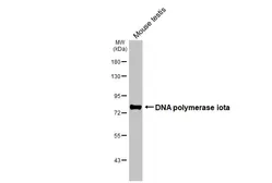 Anti-DNA polymerase iota antibody [N3C2], Internal used in Western Blot (WB). GTX112583