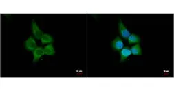 Anti-HHIP antibody [N3C2], Internal used in Immunocytochemistry/ Immunofluorescence (ICC/IF). GTX112584