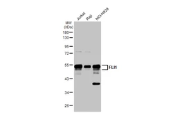 Anti-FLI1 antibody used in Western Blot (WB). GTX112937