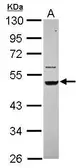 Anti-Cytokeratin 14 antibody [N3C3] used in Western Blot (WB). GTX112976