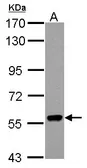 Anti-RIP2 antibody used in Western Blot (WB). GTX113044
