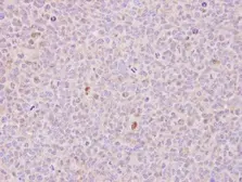 Anti-RCC1 antibody [N1C1] used in IHC (Paraffin sections) (IHC-P). GTX113402