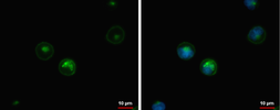 Anti-HLA-DQB1 antibody used in Immunocytochemistry/ Immunofluorescence (ICC/IF). GTX113458