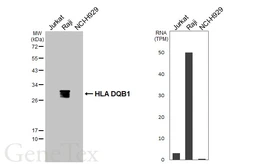 Anti-HLA-DQB1 antibody used in Western Blot (WB). GTX113458