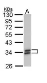 Anti-SULT1A1 antibody used in Western Blot (WB). GTX113560