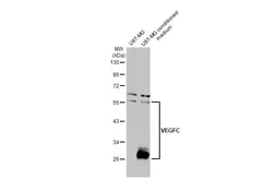 Anti-VEGFC antibody used in Western Blot (WB). GTX113574