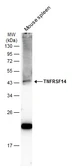 Anti-TNFRSF14 antibody [N2C3] used in Western Blot (WB). GTX113589