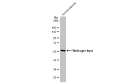 Anti-Fibrinogen beta antibody [C1C3] used in Western Blot (WB). GTX113694