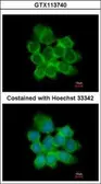 Anti-15-PGDH antibody used in Immunocytochemistry/ Immunofluorescence (ICC/IF). GTX113740