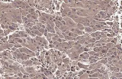 Anti-PAPSS2 antibody [N1N3] used in IHC (Paraffin sections) (IHC-P). GTX113892