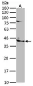 Anti-TRIB3 antibody [N3C3] used in Western Blot (WB). GTX113991
