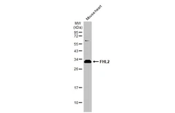 Anti-FHL2 antibody used in Western Blot (WB). GTX114071