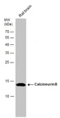 Anti-Calcineurin B antibody used in Western Blot (WB). GTX114181