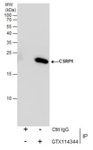 Anti-CSRP1 antibody [N1C3] used in Immunoprecipitation (IP). GTX114344