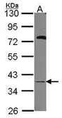 Anti-GALE antibody [N2C3] used in Western Blot (WB). GTX114419