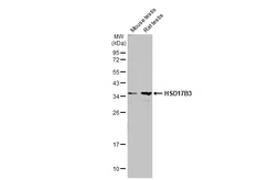 Anti-HSD17B3 antibody used in Western Blot (WB). GTX114480