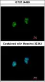 Anti-ISG20 antibody used in Immunocytochemistry/ Immunofluorescence (ICC/IF). GTX114499