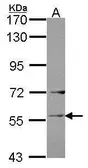 Anti-Ladinin 1 antibody [C1C3] used in Western Blot (WB). GTX114518