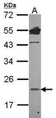 Anti-Lipocalin 1 antibody [N1C3] used in Western Blot (WB). GTX114523