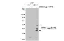 Anti-P2Y2 antibody [N3C3] used in Western Blot (WB). GTX114609
