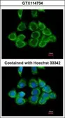 Anti-RPS2 antibody [N2C3] used in Immunocytochemistry/ Immunofluorescence (ICC/IF). GTX114734