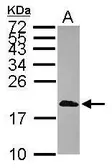 Anti-CALML3 antibody [N1C3] used in Western Blot (WB). GTX114954