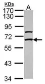 Anti-GABA Receptor Epsilon antibody [N1N3] used in Western Blot (WB). GTX115026