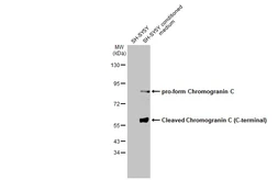 Anti-Chromogranin C antibody used in Western Blot (WB). GTX115049