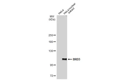 Anti-BRD3 antibody used in Western Blot (WB). GTX115058