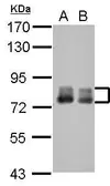 Anti-PLAP antibody [N3C2], Internal used in Western Blot (WB). GTX115226