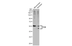 Anti-TOX antibody [N1C1] used in Western Blot (WB). GTX115287