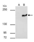 Anti-SETDB1 antibody [N1], N-term used in Immunoprecipitation (IP). GTX115305