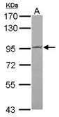 Anti-PIBF1 antibody [C1C3] used in Western Blot (WB). GTX115424