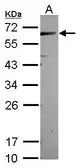 Anti-CEP57 antibody [N1C1] used in Western Blot (WB). GTX115931